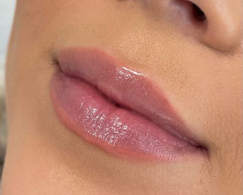 How Often Should You Get Lip Fillers to Maintain Results?